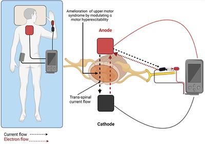 Trans-Spinal Direct Current Stimulation in Spasticity: A Literature Mini-Review